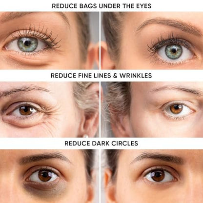 Instant Eye Tightener – Reduce Under Eye Bags, Puffiness, Dark Circles & Wrinkles | Naturally Ageless Hydrating Cream by Instaderm Avelisse