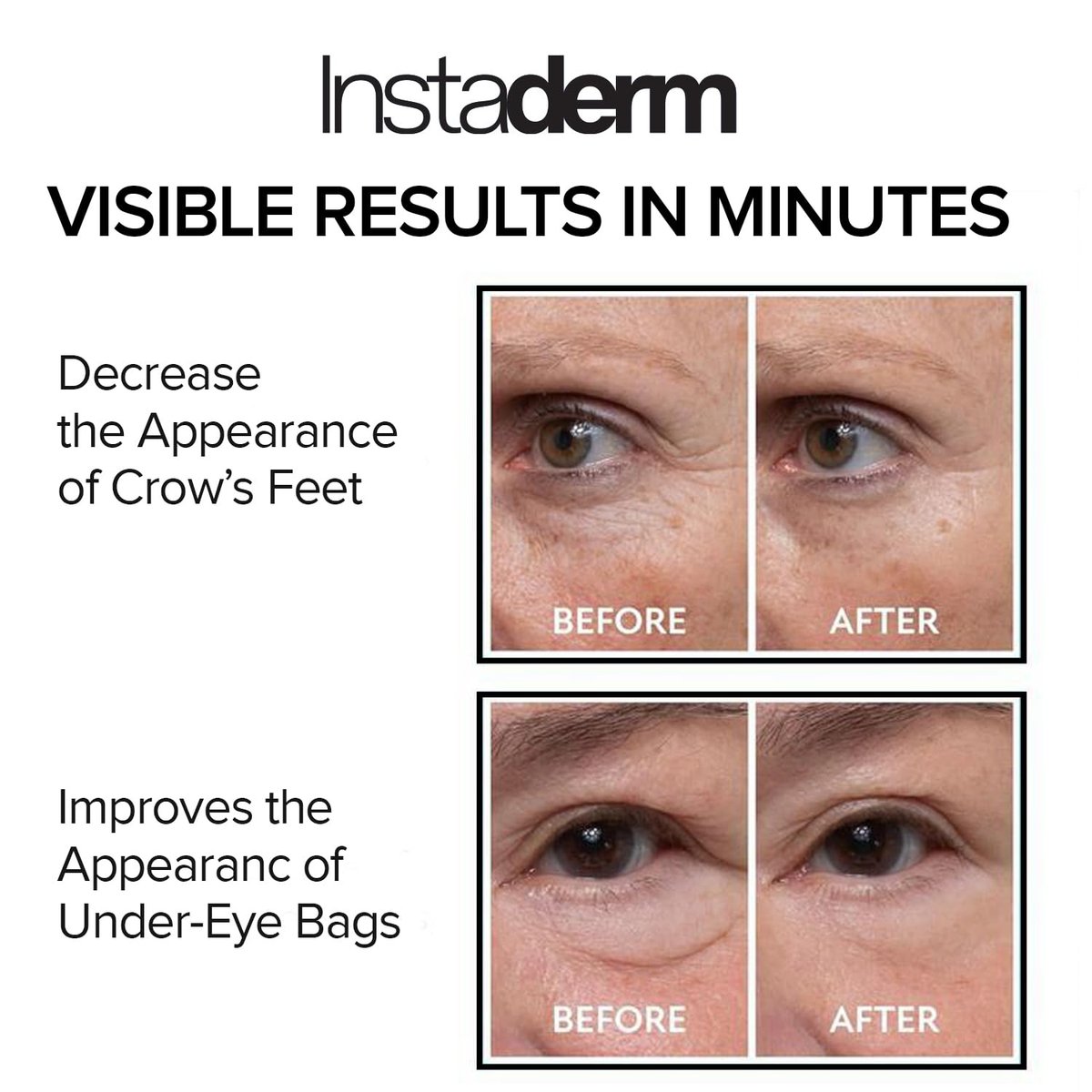 Instant Eye Tightener – Reduce Under Eye Bags, Puffiness, Dark Circles & Wrinkles | Naturally Ageless Hydrating Cream by Instaderm Avelisse