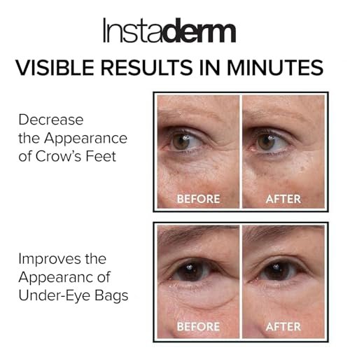 Instant Eye Tightener – Reduce Under Eye Bags, Puffiness, Dark Circles & Wrinkles | Naturally Ageless Hydrating Cream by Instaderm Avelisse