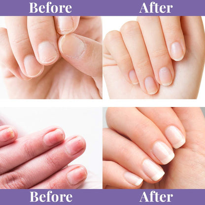 Winning Nails Chamois Buffer and Buffing Cream - Nail Buffer for Shine, Soften Cuticles, Fill Lines - 1.75 oz Set