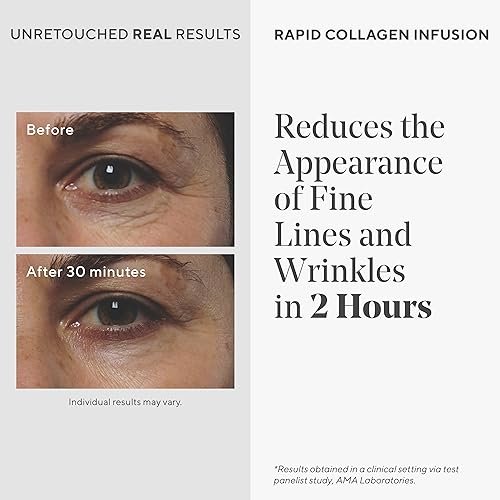 Murad Rapid Collagen Infusion – Anti-Aging Serum with Collagen Amino Acids & Winged Kelp Extract, 1 Fl Oz Avelisse