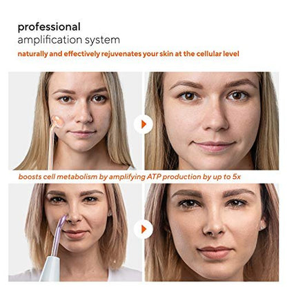 NuDerma Professional Skin Therapy Wand – Portable High Frequency Machine with 6 Glass Wands for Clear, Firm & Tightened Skin Avelisse