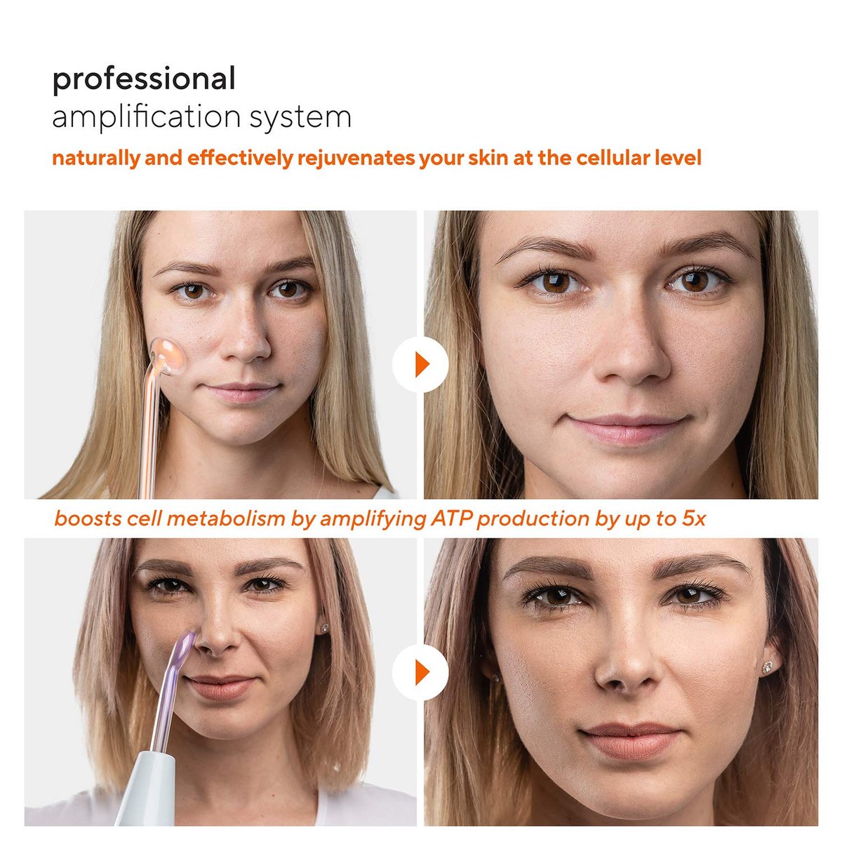 NuDerma Professional Skin Therapy Wand – Portable High Frequency Machine with 6 Glass Wands for Clear, Firm & Tightened Skin Avelisse
