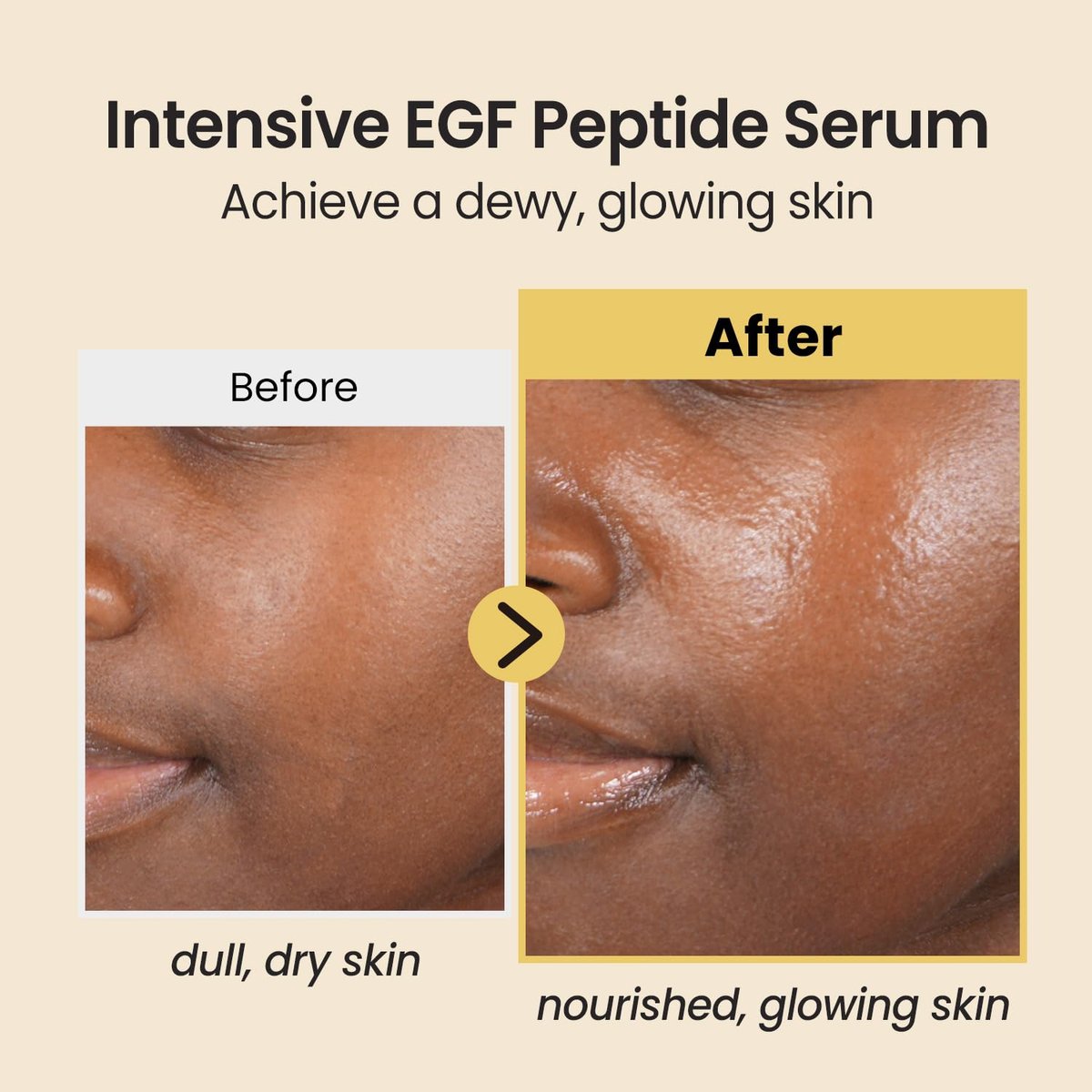Coxir Intensive EGF Peptides Serum – Korean Firming & Hydrating Face Serum with Epidermal Growth Factor - görsel 5