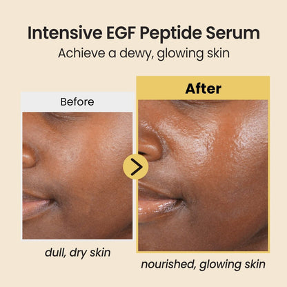 Coxir Intensive EGF Peptides Serum – Korean Firming & Hydrating Face Serum with Epidermal Growth Factor