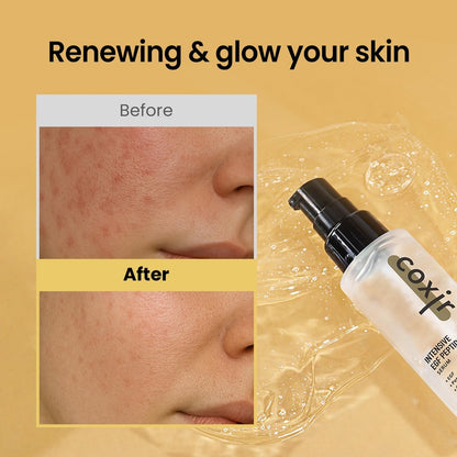 Coxir Intensive EGF Peptides Serum – Korean Firming & Hydrating Face Serum with Epidermal Growth Factor
