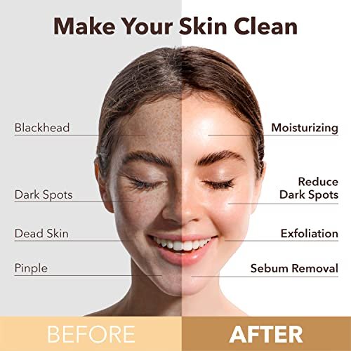 PUREDERM Deep Purifying Green O2 Bubble Mask - 5 Pack, 0.88 oz Each, Korean Beauty Bubble Mask for Deep Cleansing and Pore Care - görsel 6