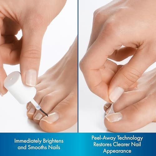 ProClearz Brite Now Nail Treatment – Restore Damaged & Discolored Nails with Peel-Away Technology, 0.5 oz Avelisse