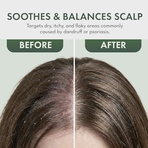 Leave In Conditioner Spray - Tea Tree Scalp Treatment - Anti-Dandruff & Itchy Scalp Relief, Hydrating & Medicated Formula for Psoriasis Care - Detangles & Nourishes Hair (8 Fl Oz) - görsel 10