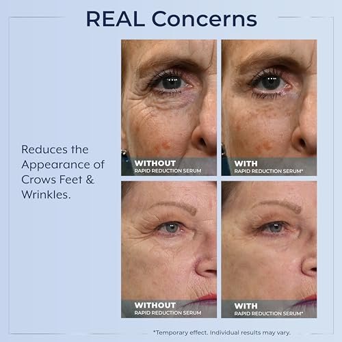 Plexaderm Rapid Reduction Eye Serum - Instantly Reduce Under-Eye Bags, Wrinkles & Dark Circles Avelisse