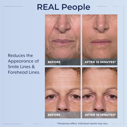 Plexaderm Rapid Reduction Eye Serum - Instantly Reduce Under-Eye Bags, Wrinkles & Dark Circles Avelisse