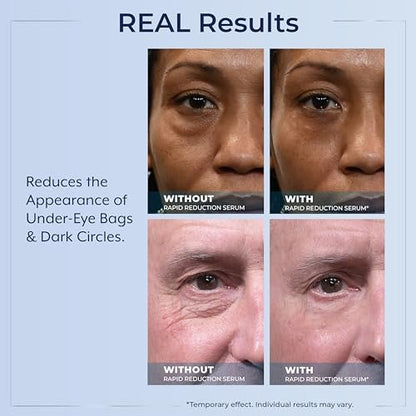 Plexaderm Rapid Reduction Eye Serum - Instantly Reduce Under-Eye Bags, Wrinkles & Dark Circles Avelisse
