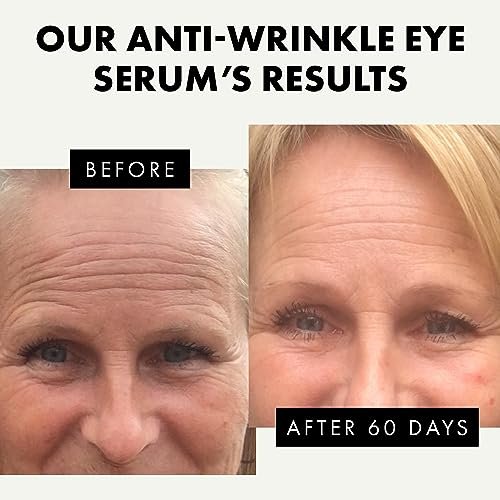 Eclat Skincare Eye Serum with Hyaluronic Acid – Hydrating Formula for Wrinkles, Fine Lines, Crow’s Feet & Eye Bags – Lightweight Serum for Dark Circles and Puffiness – Firming & Brightening 0.5 fl oz - görsel 4