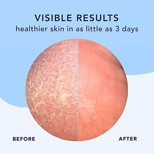 Barefoot Scientist High Dive Intensive Hydration Foot Therapy Cream - 4.06 oz Avelisse