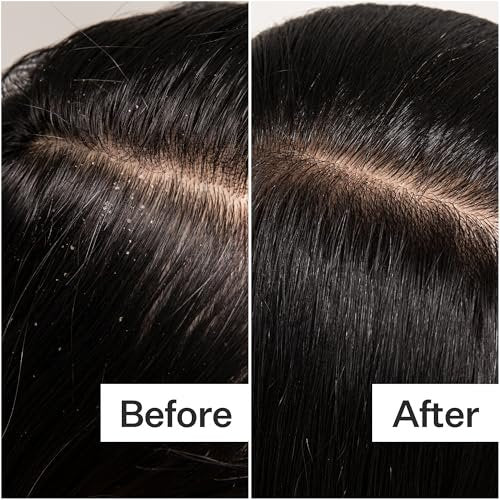 ACT+ ACRE Cold Processed Scalp Detox Oil – Sulfate-Free Care for Flaky, Dry & Itchy Scalp – Promotes Thicker, Fuller-Looking Hair Avelisse