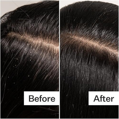 ACT+ ACRE Cold Processed Scalp Detox Oil – Sulfate-Free Care for Flaky, Dry & Itchy Scalp – Promotes Thicker, Fuller-Looking Hair Avelisse