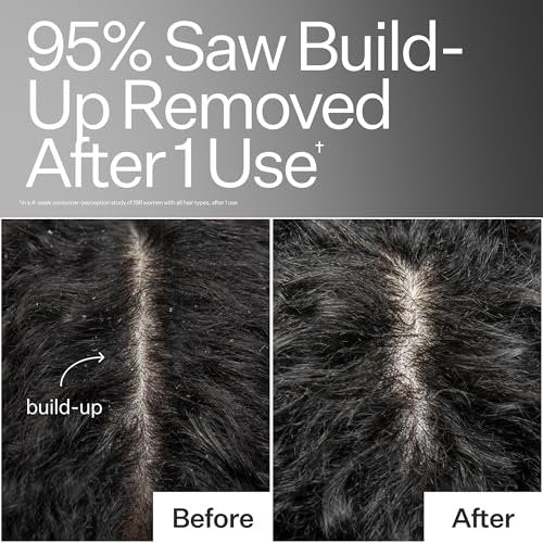 ACT+ ACRE Cold Processed Scalp Detox Oil – Sulfate-Free Care for Flaky, Dry & Itchy Scalp – Promotes Thicker, Fuller-Looking Hair Avelisse
