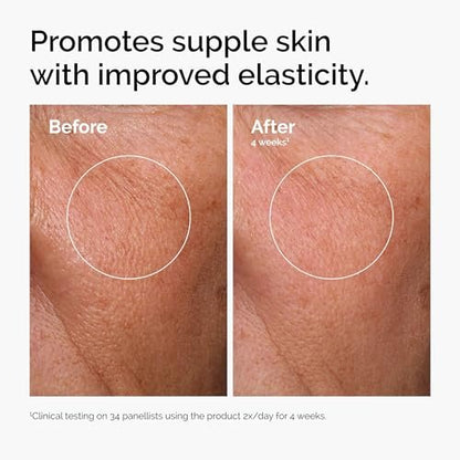 The Ordinary Serum Favorites Set: Hyaluronic Acid 2% + B5, Niacinamide 10% + Zinc 1%, Caffeine Solution 5% – Hydrating, Brightening & Pore-Minimizing Skincare Avelisse