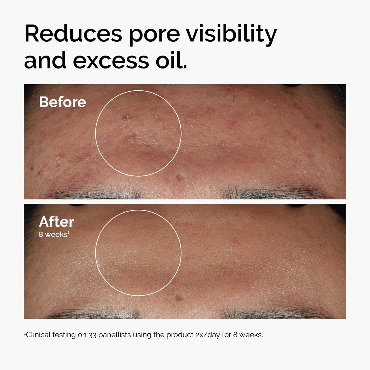 The Ordinary Serum Favorites Set: Hyaluronic Acid 2% + B5, Niacinamide 10% + Zinc 1%, Caffeine Solution 5% – Hydrating, Brightening & Pore-Minimizing Skincare Avelisse