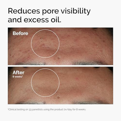 The Ordinary Serum Favorites Set: Hyaluronic Acid 2% + B5, Niacinamide 10% + Zinc 1%, Caffeine Solution 5% – Hydrating, Brightening & Pore-Minimizing Skincare Avelisse