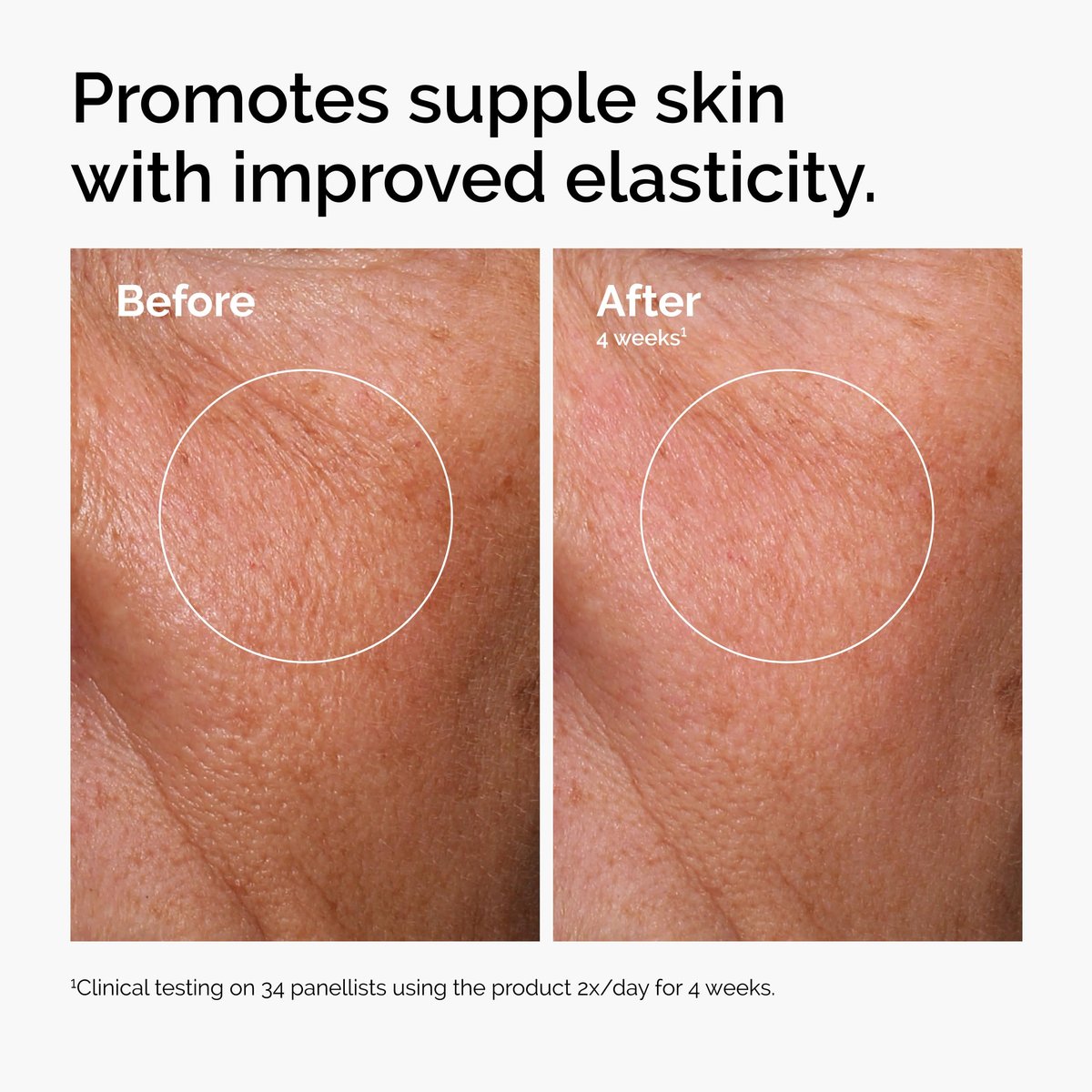 The Ordinary Serum Favorites Set: Hyaluronic Acid 2% + B5, Niacinamide 10% + Zinc 1%, Caffeine Solution 5% – Hydrating, Brightening & Pore-Minimizing Skincare Avelisse