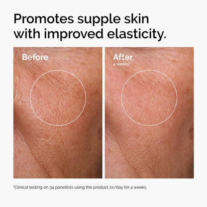 The Ordinary Serum Favorites Set: Hyaluronic Acid 2% + B5, Niacinamide 10% + Zinc 1%, Caffeine Solution 5% – Hydrating, Brightening & Pore-Minimizing Skincare Avelisse