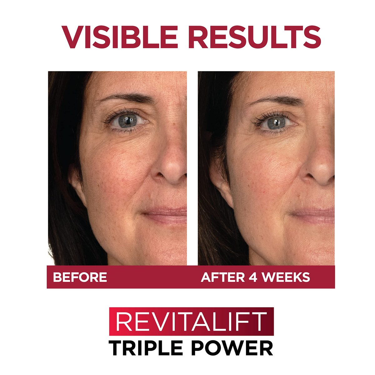 L'Oreal Paris Revitalift 1.5% Pure – Dimensions: 3.19 x 4.75 x 6.13 inches – Image 9
