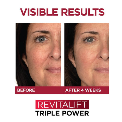 L'Oreal Paris Revitalift 1.5% Pure – Dimensions: 3.19 x 4.75 x 6.13 inches – Image 9