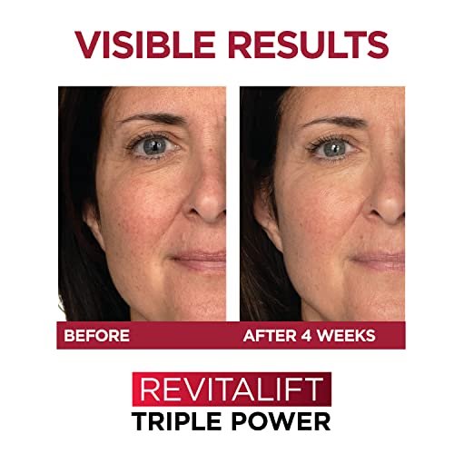 L'Oreal Paris Revitalift 1.5% Pure – Color: White packaging – Image 10