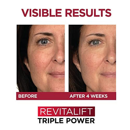 L'Oreal Paris Revitalift 1.5% Pure – Color: White packaging – Image 10