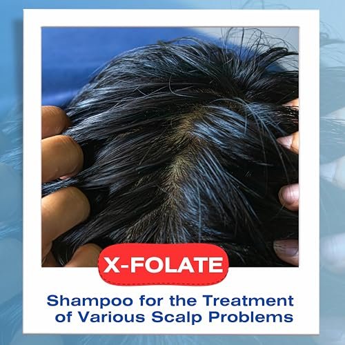 Mediceuticals X-Folate Anti-Dandruff Shampoo – Persistent Dandruff Control for Scaly, Flaky Scalp – Reduces Itching – 8.45 oz Avelisse