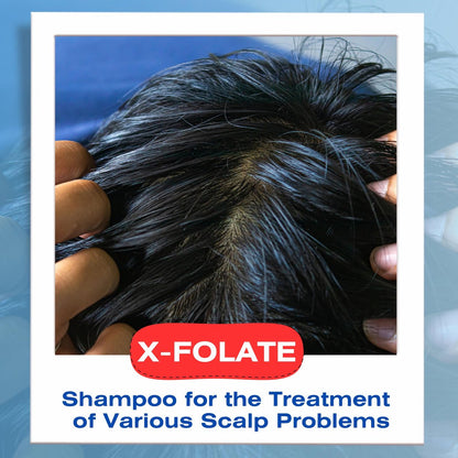 Mediceuticals X-Folate Anti-Dandruff Shampoo – Persistent Dandruff Control for Scaly, Flaky Scalp – Reduces Itching – 8.45 oz Avelisse