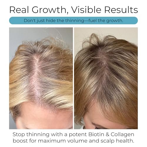 Hush & Hush Biotin and Collagen Hair Growth Supplements – Hair Vitamins for Women with Ashwagandha – Supports Regrowth, Thicker Hair & Volume – Reduces Hair Loss & Thinning – 120 Capsules Avelisse