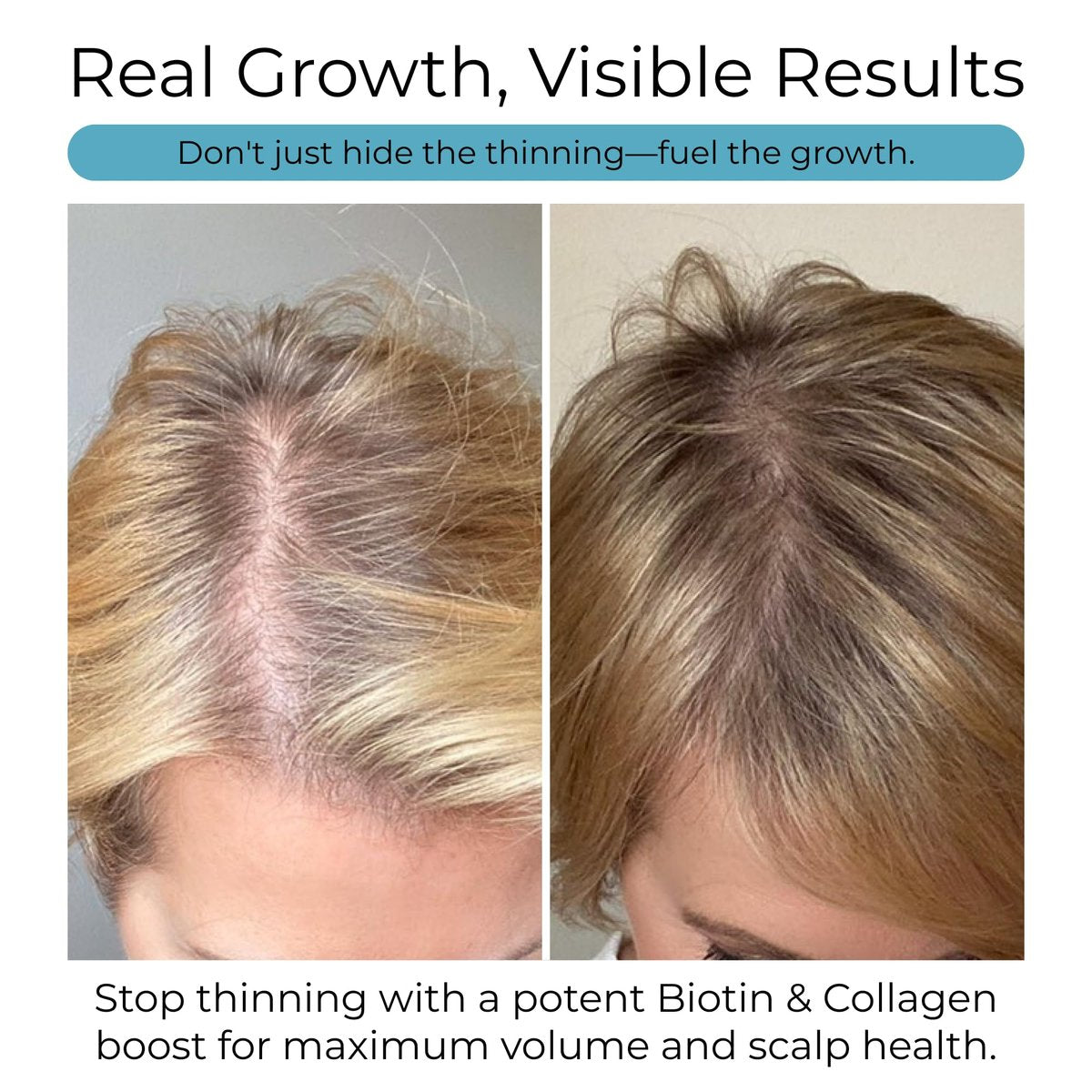 Hush & Hush Biotin and Collagen Hair Growth Supplements – Hair Vitamins for Women with Ashwagandha – Supports Regrowth, Thicker Hair & Volume – Reduces Hair Loss & Thinning – 120 Capsules Avelisse