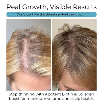 Hush & Hush Biotin and Collagen Hair Growth Supplements – Hair Vitamins for Women with Ashwagandha – Supports Regrowth, Thicker Hair & Volume – Reduces Hair Loss & Thinning – 120 Capsules Avelisse