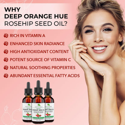 Jeune Naturelle Organic Rosehip Seed Oil - Pure, Virgin, Cold Pressed for Skin Repair, 2 oz