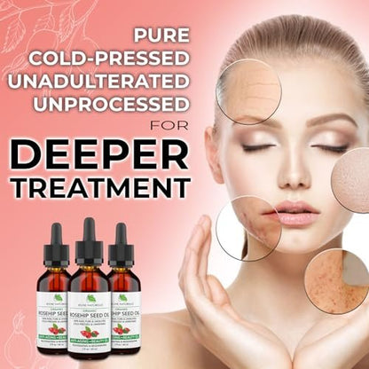 Jeune Naturelle Organic Rosehip Seed Oil - Pure, Virgin, Cold Pressed for Skin Repair, 2 oz