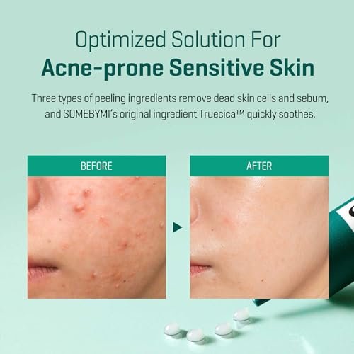 SOME BY MI AHA BHA PHA 14 Days Super Miracle Spot All Kill Cream - 1.01 oz, 30 ml - Hyaluronic Acid & Centella Face Moisturizer for Troubled Skin Care - Hydrating & Soothing Formula - Korean Skin Care Avelisse