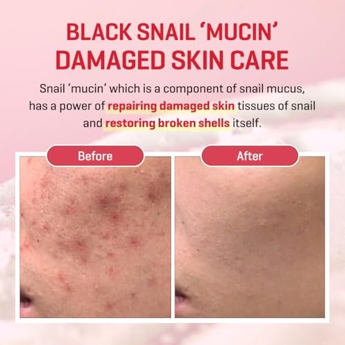 SOME BY MI Snail Trucica Miracle Repair Serum - Snail Mucin Face Serum for Sensitive Skin, Daily Repair for Post Acne Marks & Skin Barrier, 1.69 oz (50 ml) - Korean Skincare Avelisse