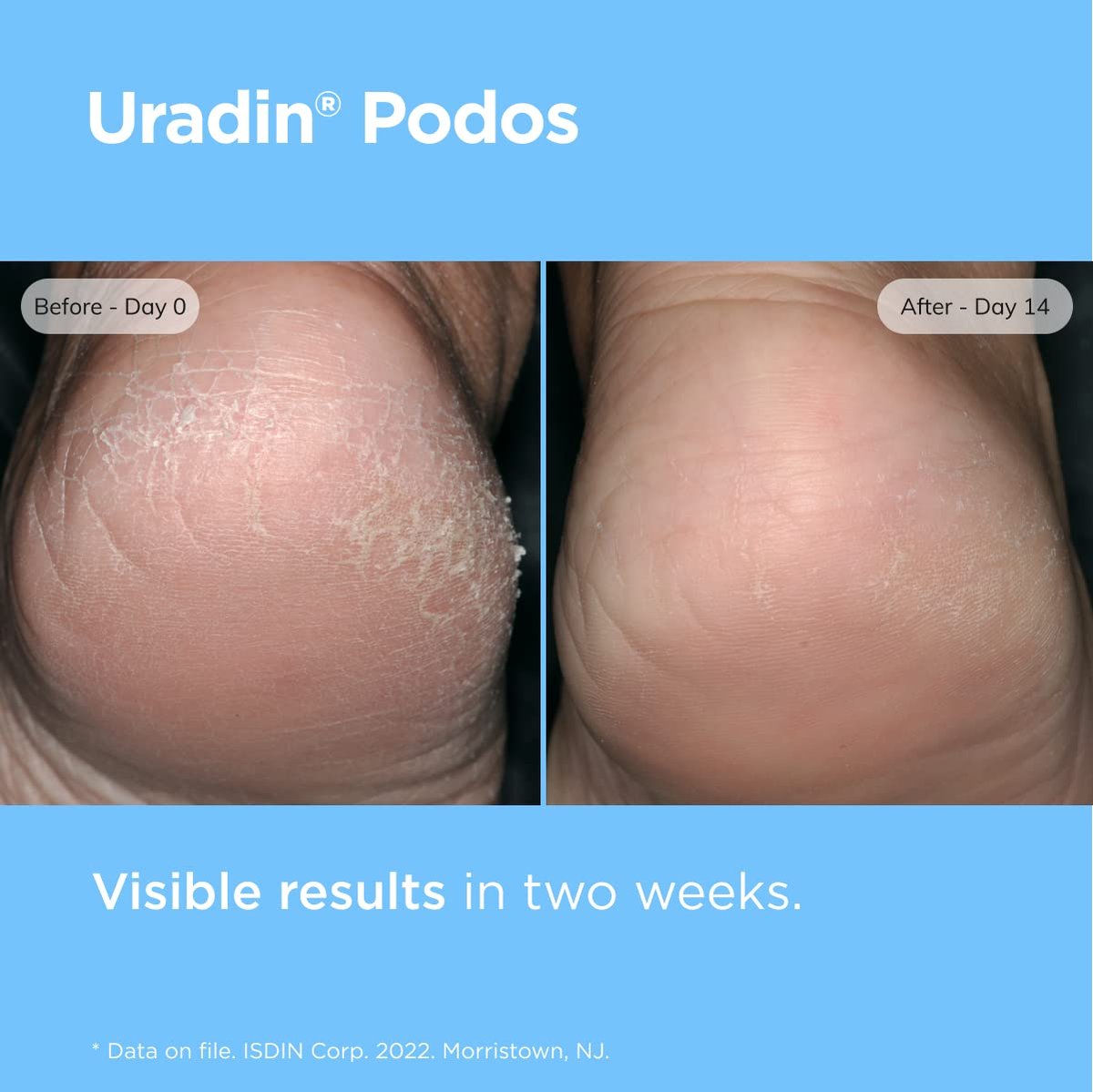 ISDIN Uradin Podos Gel Oil Foot Cream - 10% Urea for Dry, Cracked Feet - Fast Absorbing & Dermatologically Tested - 2.5 Fl Oz Avelisse