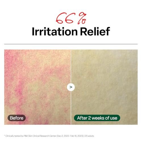Dr. G R.E.D. Blemish Clear Soothing Toner - Korean Soothing Toner for Glowing Skin - Soothes Irritation, Clear Skin - Mild Exfoliant with AHA, BHA & Centella Asiatica - 10.14 fl oz - görsel 9