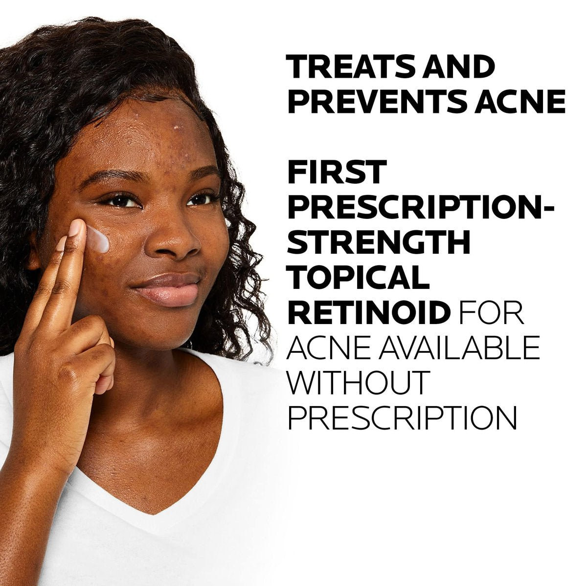La Roche-Posay Effaclar Adapalene Gel 0.1% Acne Treatment – Retinoid Cream for Blackheads & Whiteheads – Oil-Free Acne Medication – 1.6 Fl Oz Avelisse
