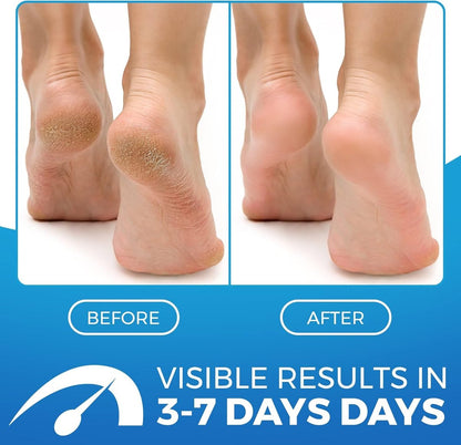 Imperial Feet 2 in 1 Foot Cream for Dry Cracked Heels - XL Foot Repair Cream for Dry Feet - Suitable for Diabetics - Professional Grade