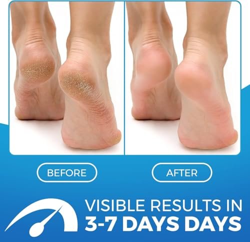 Imperial Feet 2 in 1 Foot Cream for Dry Cracked Heels - XL Foot Repair Cream for Dry Feet - Suitable for Diabetics - Professional Grade - görsel 4