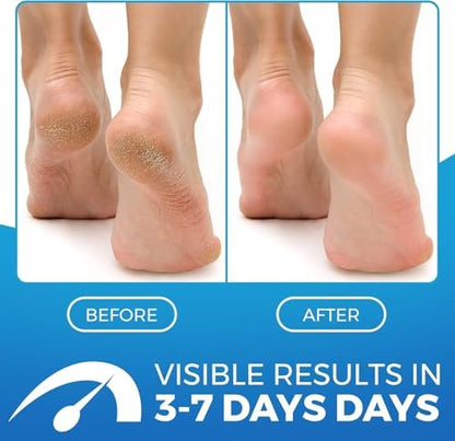 Imperial Feet 2 in 1 Foot Cream for Dry Cracked Heels - XL Foot Repair Cream for Dry Feet - Suitable for Diabetics - Professional Grade