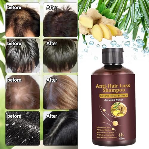 CIDBEST Hair Growth Shampoo – Anti-Thinning & Thickening Shampoo for Hair Loss for Men & Women, 220ml Avelisse