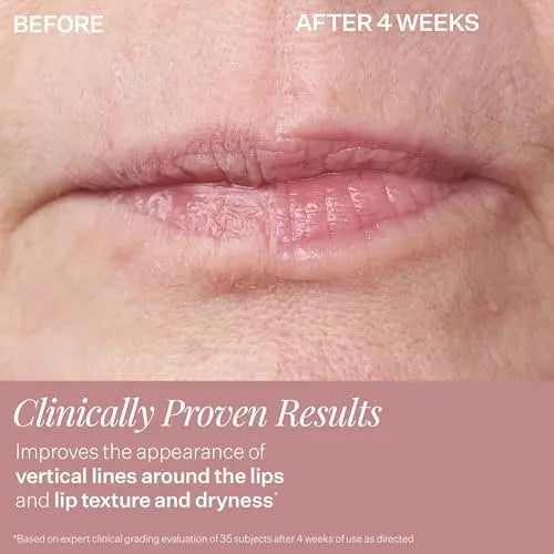 StriVectin DoubleFix for Lips 2-in-1 Lip Fix Plumping Treatment & Vertical Line Treatment Avelisse