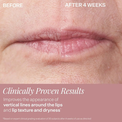 StriVectin DoubleFix for Lips 2-in-1 Lip Fix Plumping Treatment & Vertical Line Treatment Avelisse