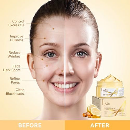 Turmeric Vitamin C Face Mask – Deep Cleansing Clay Mask for Dull Skin, Refining Pores & Controlling Oil, Smooth & Radiant Skin, 4.23 oz