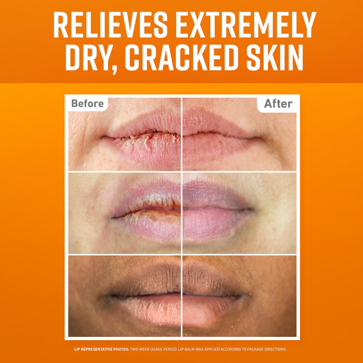 O'Keeffe's Lip Repair Lip Balm Set for Dry, Cracked Lips - Stick (Pack of 3: 1 Cooling + 1 Unscented + 1 SPF) - Moisturizer for Extremely Cracked, Dry Lips - görsel 3